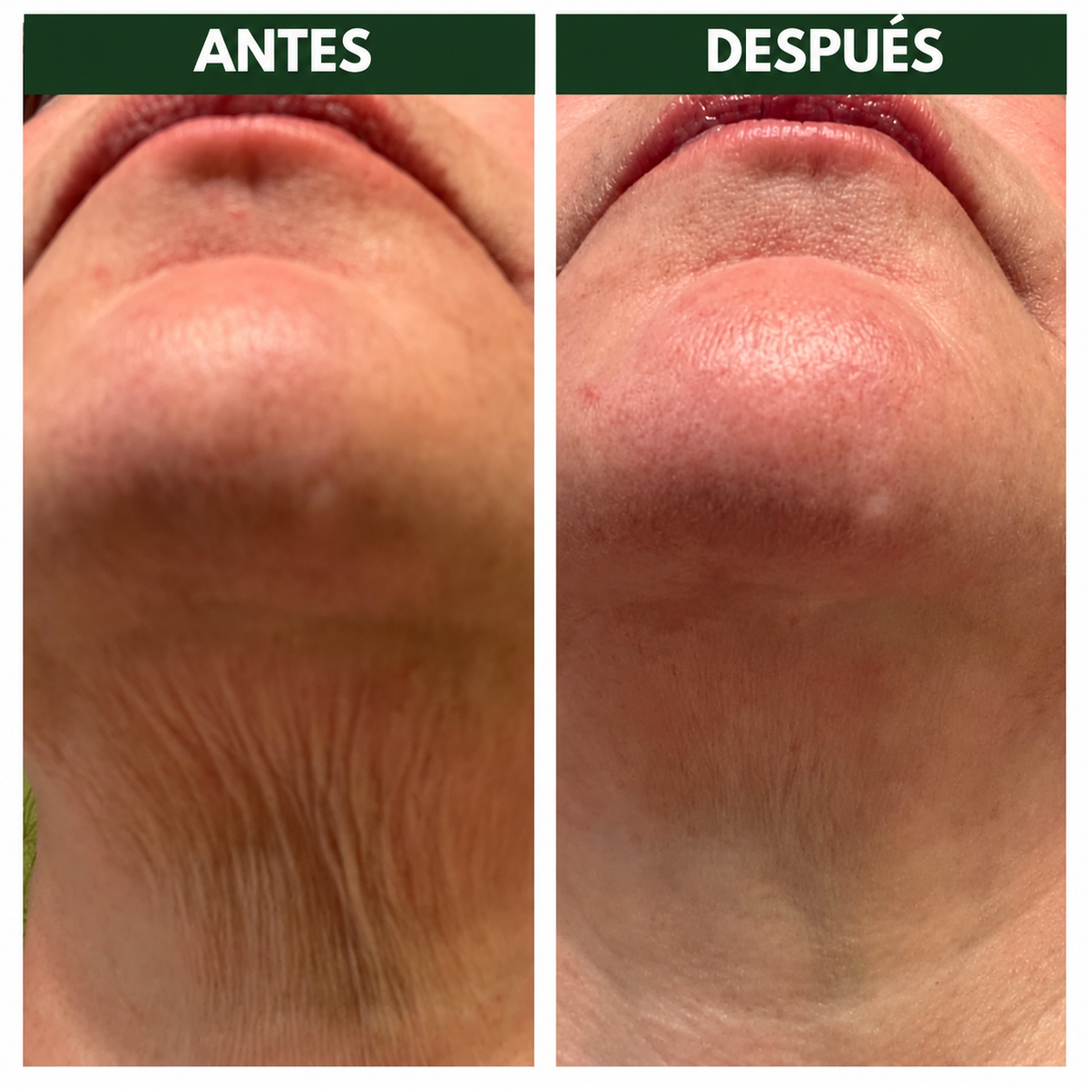 VELUNE LABS® | ELASTICIDAD, FIRMEZA Y CUIDADO DE TU PIEL