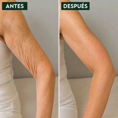 VELUNE LABS® | ELASTICIDAD, FIRMEZA Y CUIDADO DE TU PIEL